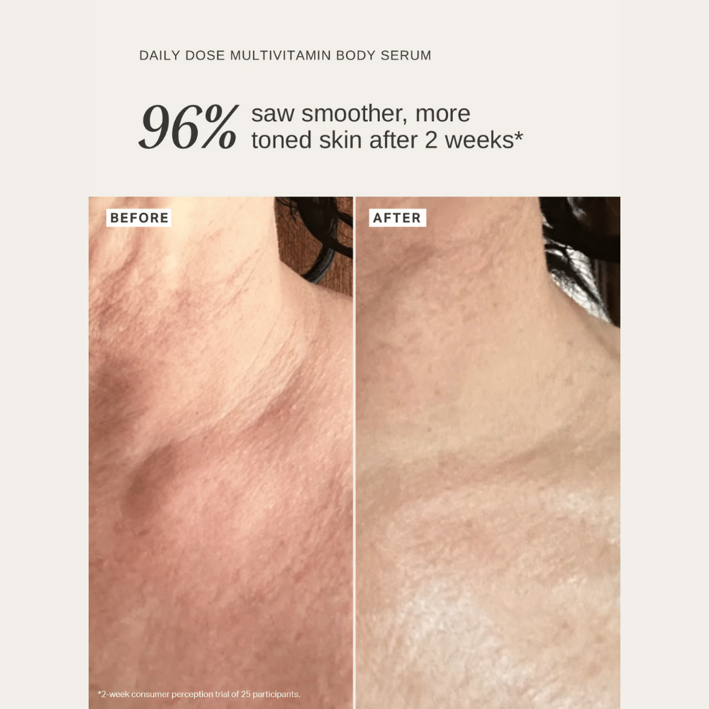 Alpha-H Daily Dose Multivitamin Body Serum 150ml