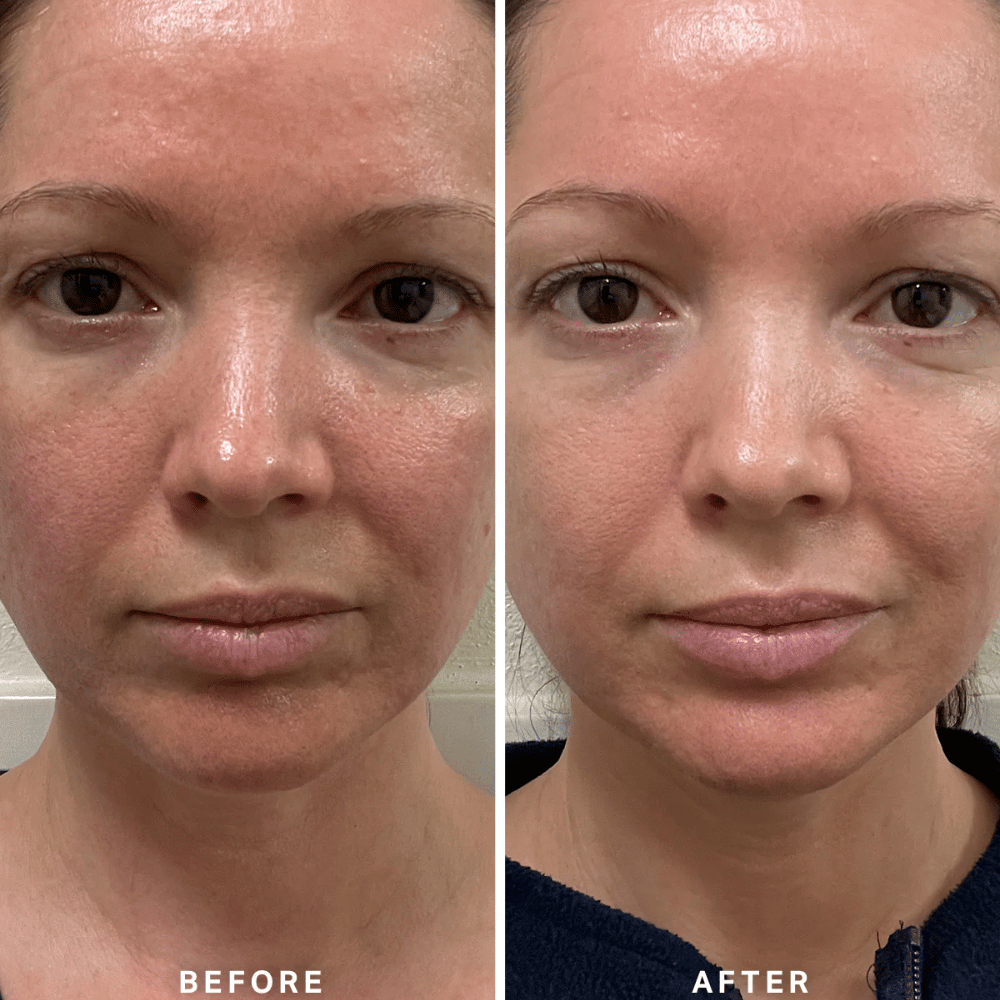 Alpha-H Vitamin B Serum with 5% Niacinamide 10ml