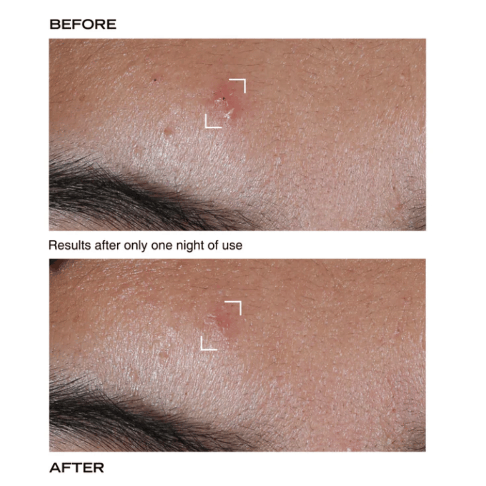 PAYOT Pate Grise Stop Pimple Original Paste 15ml