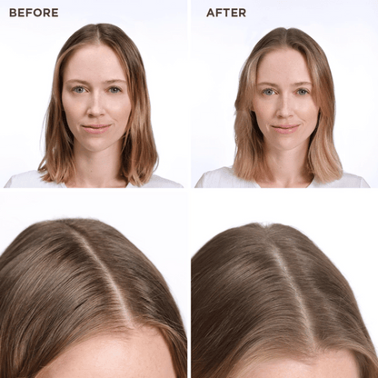 Phyto SOFTNESS Dry Shampoo 75ml