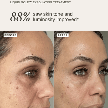 Alpha-H Holiday Edition Liquid Gold To-Go 30ml