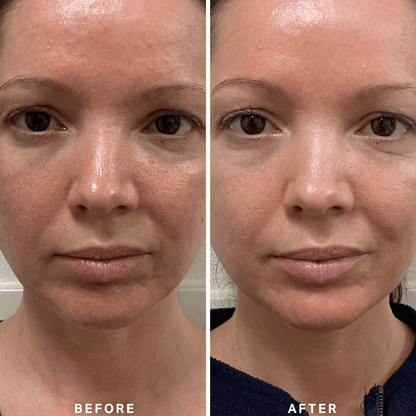 Alpha-H Vitamin B Serum with 5% Niacinamide 10ml