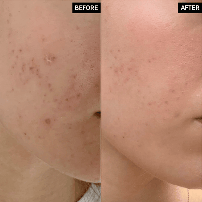 The Inkey List Mandelic Acid Treatment