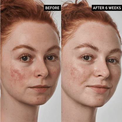 The INKEY List Redness Relief Solution